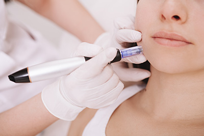 Microneedling Warner Robins GA